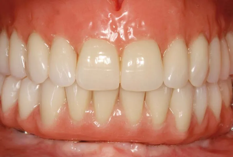 comment garder vos gencives en bonne santé avec une hygiène bucco-dentaire appropriée