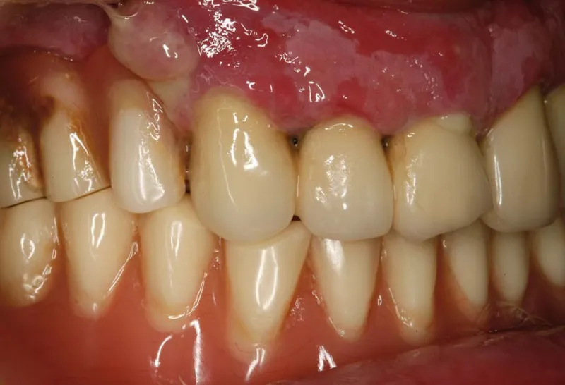 comment les boissons acides affectent nos dents et comment les protéger, conseils pour préserver votre émail