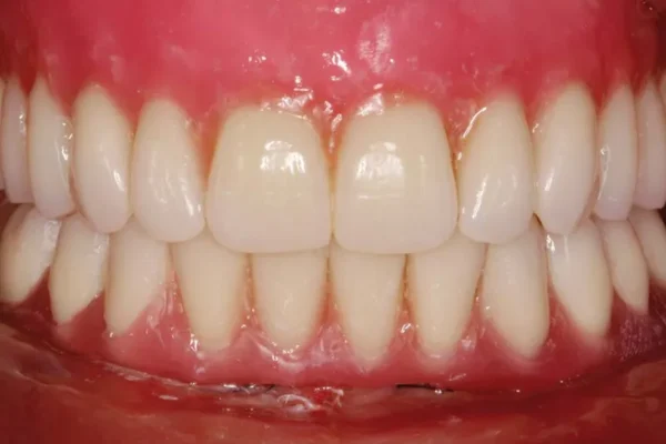 L’influence du pH dans la bouche sur l’hygiène bucco-dentaire Linfluence du pH dans la bouche et sa relation avec lhygiene bucco dentaire 1