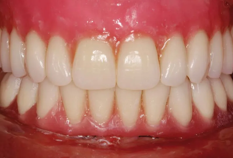 top 10 des bains de bouche pour une bouche fraîche et saine, découvrez les meilleures options