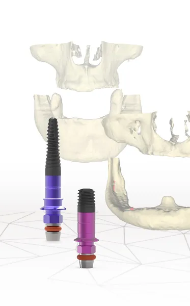 dentsply sirona france leader en technologie dentaire