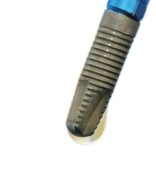 garantie implant dentaire : ce que vous devez savoir