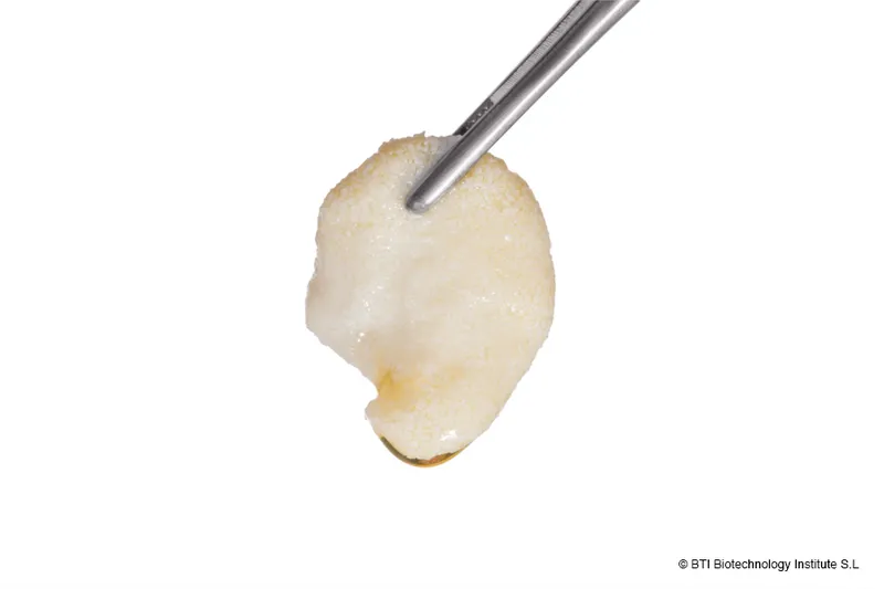 guided bone regeneration
