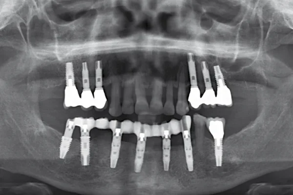 panthera dental canada