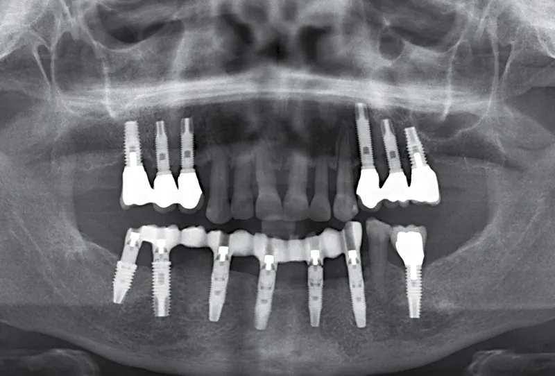 panthera dental canada