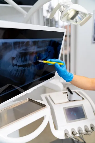 radiographies pour un implant dentaire, importance et nécessité pour le traitement