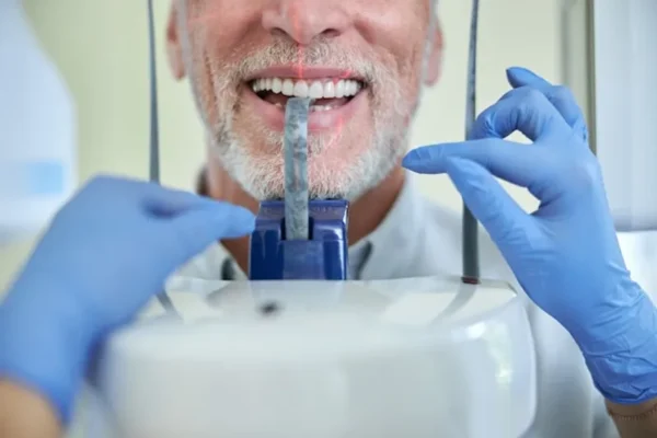 FRPC en dentisterie regeneration osseuse et traitement implantaire
