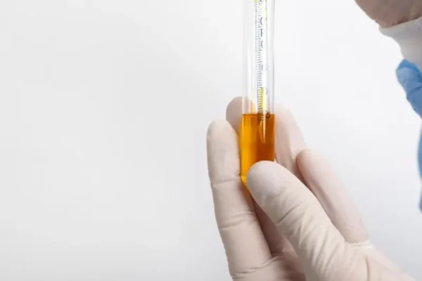 Quest ce que le plasma riche en facteurs de croissance PRGF Titre egalement